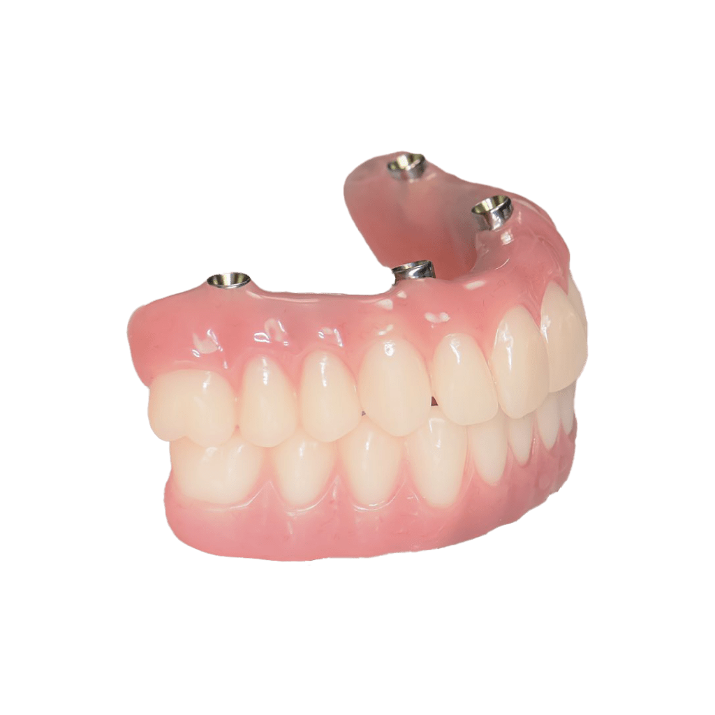 all-on-4 all-on-6 all-on-8.png dental implants