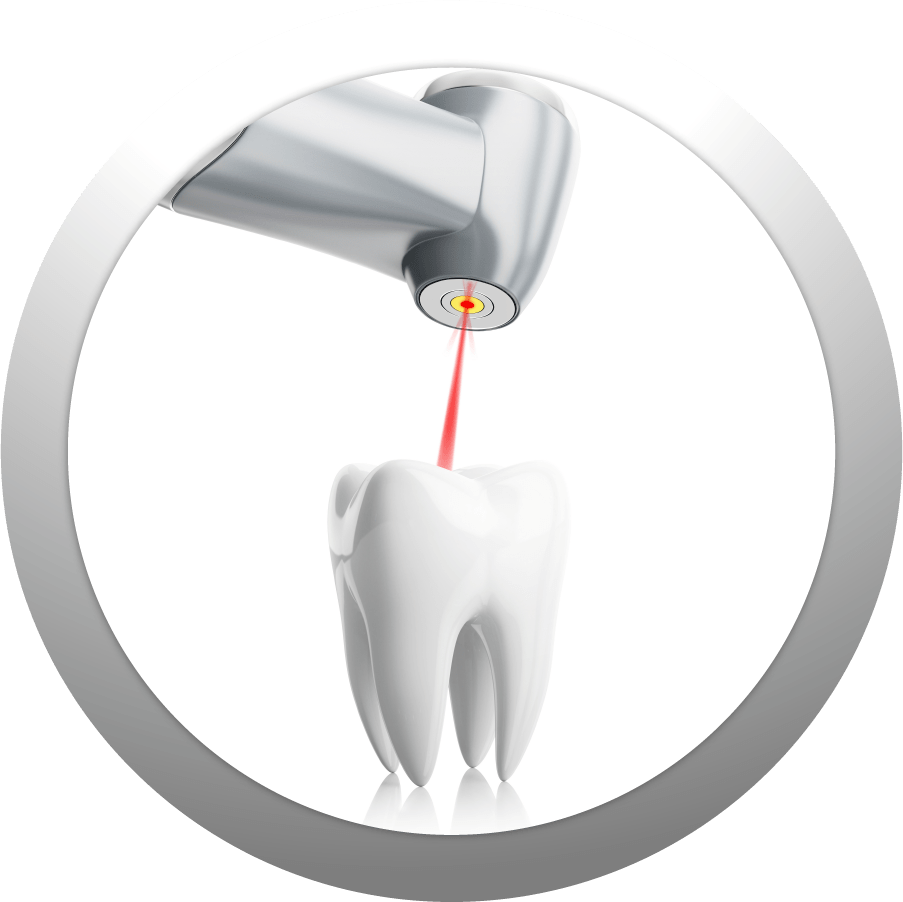 Laser Dentistry